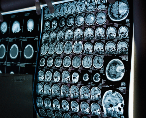 Neurological brain scan